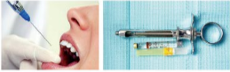 胰島素，牙科麻醉6.png